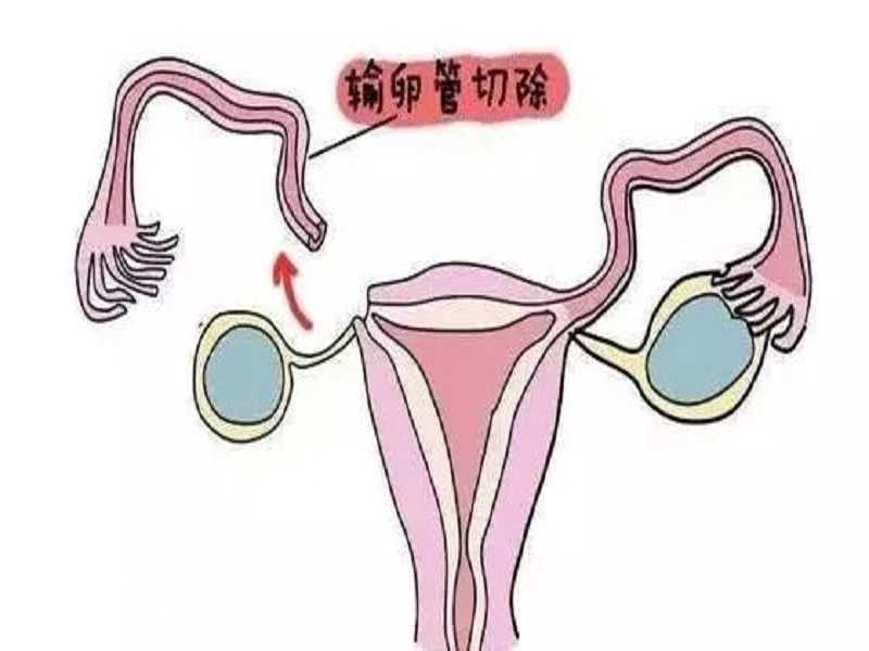 广州供卵医院看坤和助孕ok官网