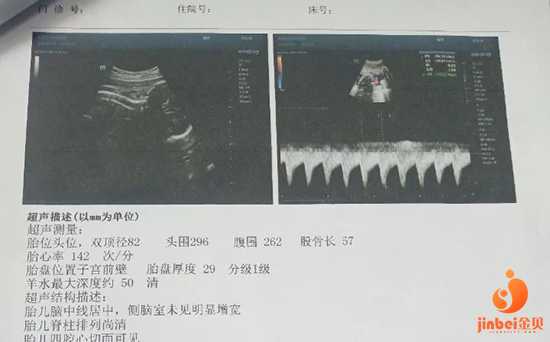 广东代孕机构费用问题,2022年广州做供卵试管婴儿医院排名，附供卵医院明细！