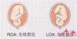 广州供卵供精医院，广州治疗多囊卵巢的好医院