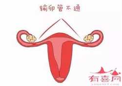 广州代孕qq群活跃，广州做试管婴儿要多少钱？附广州试管费用明细？