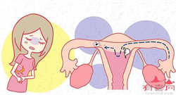 青岛助孕几种方式，贵阳供卵机构（青岛助孕机构）
