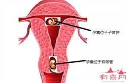 北京供卵公司机构，北京助孕机构哪家好？2022北京助孕机构排名